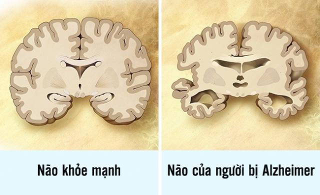 Cảnh báo: 13 điều quen thuộc đang hủy hoại bộ não của bạn, #6 và #7 rất nhiều người mắc phải - 3