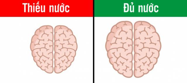 Cảnh báo: 13 điều quen thuộc đang hủy hoại bộ não của bạn, #6 và #7 rất nhiều người mắc phải - 9