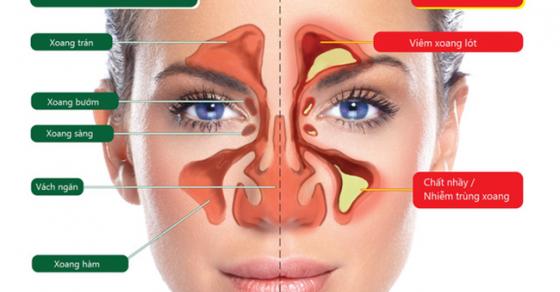 Bác sĩ Mỹ hướng dẫn cách giảm đau do viêm xoang chỉ trong 1 phút