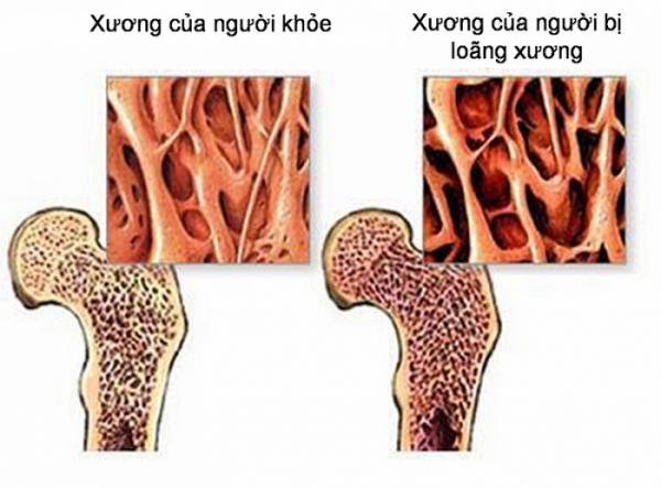 Hạt dưa hấu: Thần dược chữa tiểu đường, điều hòa huyết áp - 4