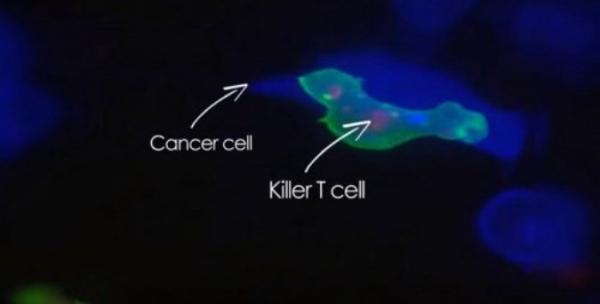 ‘Sát thủ chính nghĩa’ trong cơ thể người đi tiêu diệt tế bào ung thư - 2
