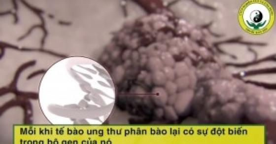 ‘Toát mồ hôi’ khi tận mắt chứng kiến tế bào ung thư di chuyển như phá trong cơ thể